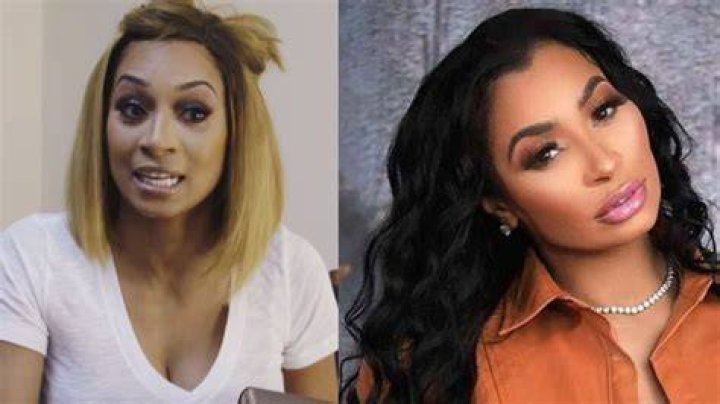 Karlie Redd Before Plastic Surgery