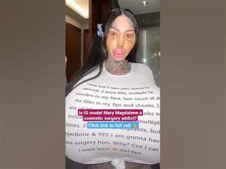 Mary Magadalene Plastic Surgery