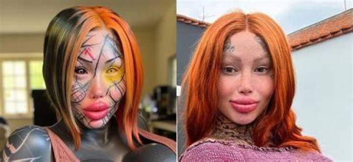 Mary Magdalene Plastic Surgery